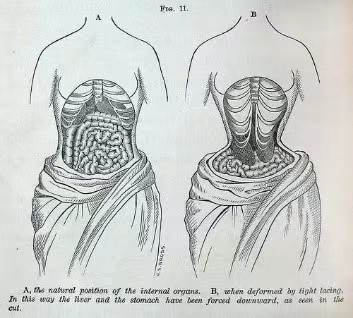 紧身胸衣满足了特殊服饰癖?