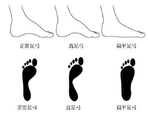 jio控:希腊脚,埃及脚,罗马脚,你喜欢哪种脚型?